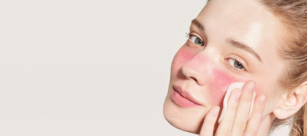 Dealing with red, reactive skin and rosacea? Skin that flushes, blushes and is easily irritated? You're not alone.