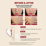 K-Secret Seoul 1988 Cream 100ml – Snail Mucin 93% + Rice Hydrating Facial Cream