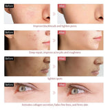 7 Colors LED Facial Mask - Wireless Face Care supports everyday comfortment