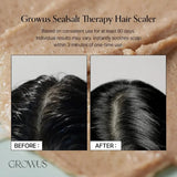 Growus Sea Salt Therapy Scalp Scaler 250g – Deep Cleansing Sea Salt Scalp Scrub for Fresh Scalp Care