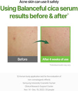 Torriden Balanceful Serum (50ml)