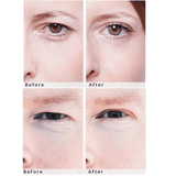 WONDERSTRIPES (M+L) Beauty Patches - orginal upper eyelid lifting tape